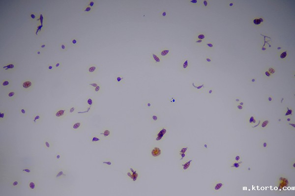 植物病害孢子图片 植物病害孢子图片